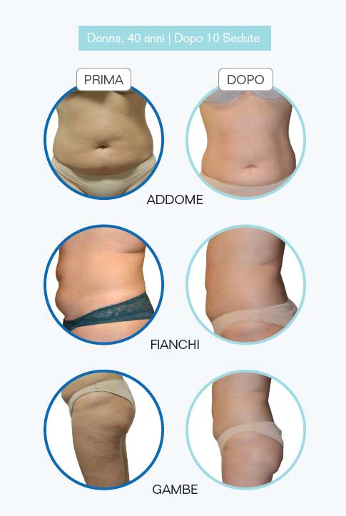 power-shape-2